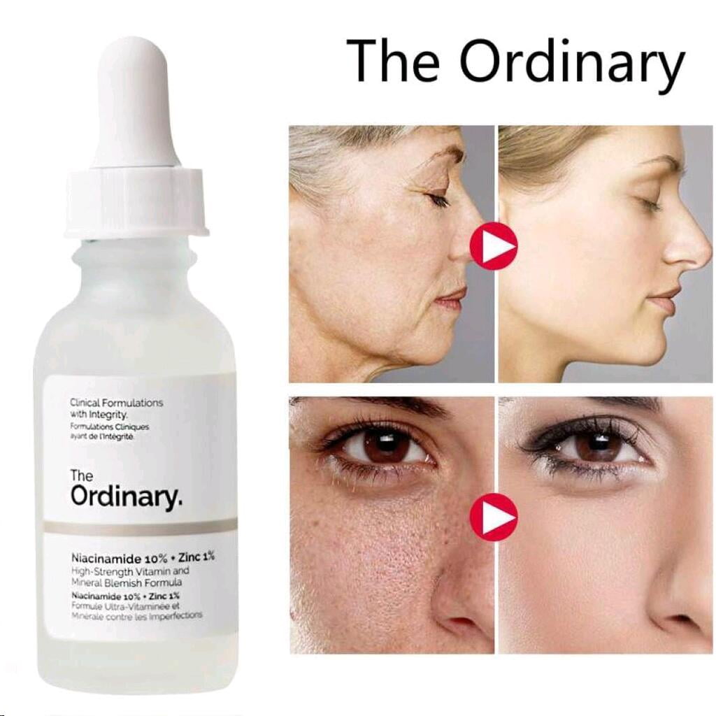 Ordinary Niacinamide 10%+Zinc 1% 30 ml Serum